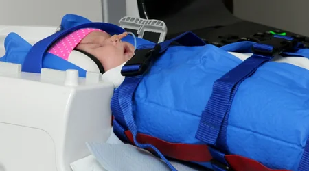 تجربه  «تغذیه و قنداق کردن» جهت انجام MRI مغز در نوزادان تا شش ماهگی