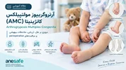 آرتروگریپوز مولتی‌پلکس کانجنیتا (AMC): Arthrogryposis Multiplex Congenita